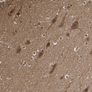 NBP1-90337 - 14-3-3 protein theta